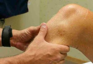 Effects of a Knee Ligament Injury