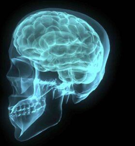 Traumatic Brain Injury